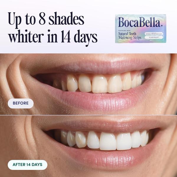 Teeth Whitening Strips for Sensitive Teeth – Natural, Peroxide-Free & Enamel-Safe | Clinically Tested Papaya & Pineapple Enzymes + Aloe & Coconut Oil | 7 Treatments for a Brighter